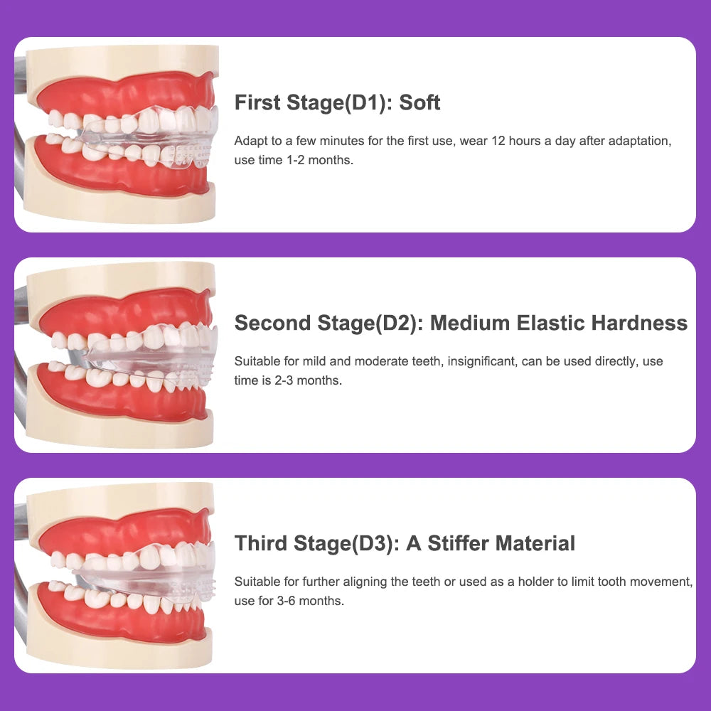 Multi-Stage Orthodontic Teeth Trainer