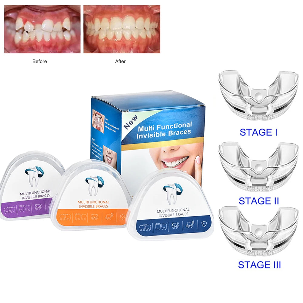 Silicone Teeth Alignment Guard